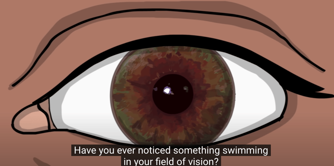 eye floaters
